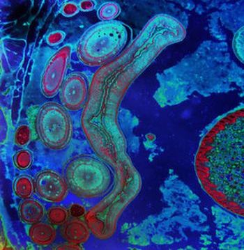 Certain infectious and parasitic diseases 