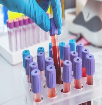 Symptoms, signs and abnormal clinical and laboratory findings, not elsewhere classified 